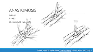 ANASTOMOSIS
DISTALES
4-6 MM
10-20% MAYOR EN INJERTO
Kirklin, James K; Barrat-Boyes. Cardiac Surgery. Elsevier. 4ª ED. 2013 Chap 7.
 