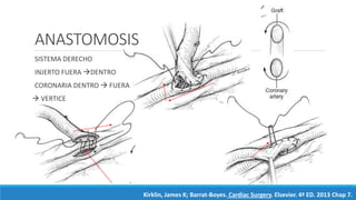 ANASTOMOSIS
SISTEMA DERECHO
INJERTO FUERA DENTRO
CORONARIA DENTRO  FUERA
 VERTICE
Kirklin, James K; Barrat-Boyes. Cardiac Surgery. Elsevier. 4ª ED. 2013 Chap 7.
 