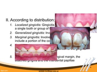 19. Stages of gingivitis. ppt explaining | PPT