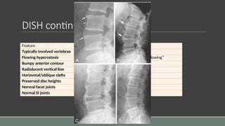 Bumpy Dih Arthritis in children and young adult - overview | PPTX