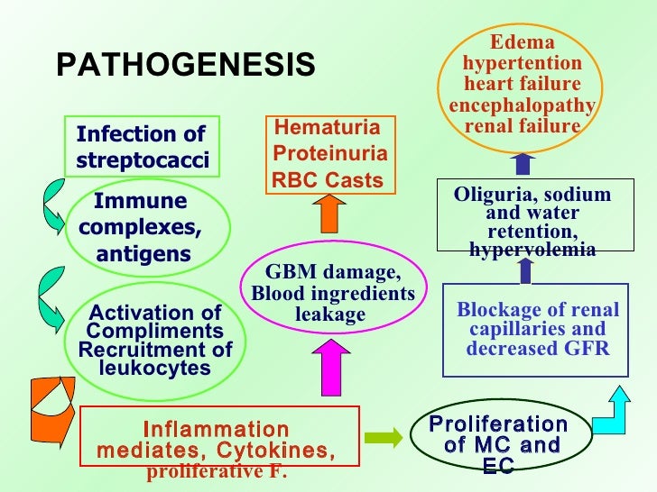19 Acute Glomerulonephritis