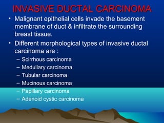 Invasive Ductal Carcinoma Presentation
