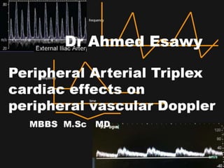 19 cardaic effects on peripheral vascular doppler dr ahmed esawy