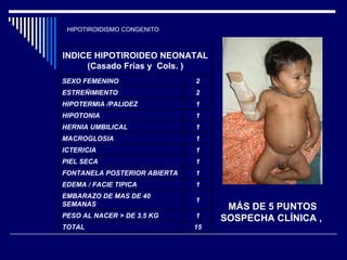 HIPOTIROIDISMO CONGENITO MÁS DE 5 PUNTOS SOSPECHA CLÍNICA ,  15 TOTAL 1 PESO AL NACER > DE 3.5 KG 1 EMBARAZO DE MAS DE 40 SEMANAS 1 EDEMA / FACIE TIPICA 1 FONTANELA POSTERIOR ABIERTA 1 PIEL SECA 1 ICTERICIA 1 MACROGLOSIA 1 HERNIA UMBILICAL 1 HIPOTONIA 1 HIPOTERMIA /PALIDEZ 2 ESTREÑIMIENTO 2 SEXO FEMENINO INDICE HIPOTIROIDEO NEONATAL (Casado Frías y  Cols. ) 