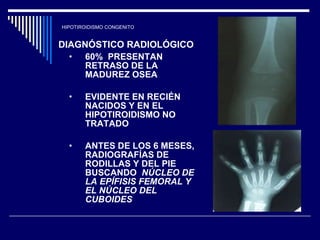 HIPOTIROIDISMO CONGENITO DIAGNÓSTICO RADIOLÓGICO   60%  PRESENTAN RETRASO DE LA MADUREZ OSEA EVIDENTE EN RECIÉN NACIDOS Y EN EL HIPOTIROIDISMO NO TRATADO  ANTES DE LOS 6 MESES, RADIOGRAFÍAS DE RODILLAS Y DEL PIE BUSCANDO  NÚCLEO DE LA EPÍFISIS FEMORAL Y EL NÚCLEO DEL CUBOIDES  
