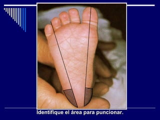 Identifique el área para puncionar. 