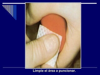 Limpie el área a puncionar. 