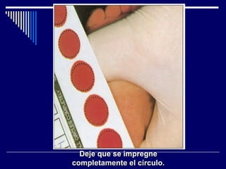 Deje que se impregne completamente el círculo. 
