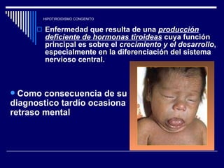 HIPOTIROIDISMO CONGENITO Enfermedad que resulta de una  producción deficiente de hormonas tiroideas  cuya función principal es sobre el  crecimiento y el desarrollo , especialmente en la diferenciación del sistema nervioso central. Como consecuencia de su diagnostico tardío ocasiona retraso mental  