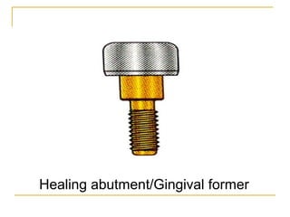 Healing abutment/Gingival former 
 