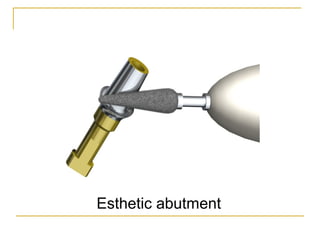 Esthetic abutment 
 