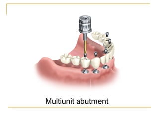 Multiunit abutment 
 