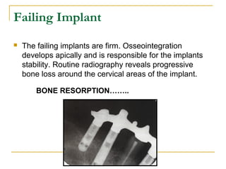 Failing Implant 
 The failing implants are firm. Osseointegration 
develops apically and is responsible for the implants 
stability. Routine radiography reveals progressive 
bone loss around the cervical areas of the implant. 
BONE RESORPTION…….. 
 
