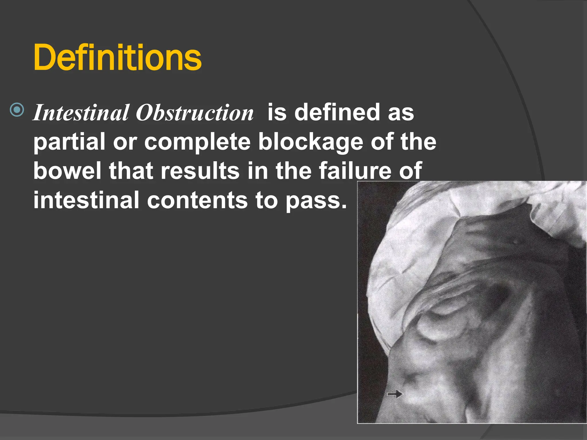 Definitions
 Intestinal Obstruction is defined as
partial or complete blockage of the
bowel that results in the failure of
intestinal contents to pass.
 