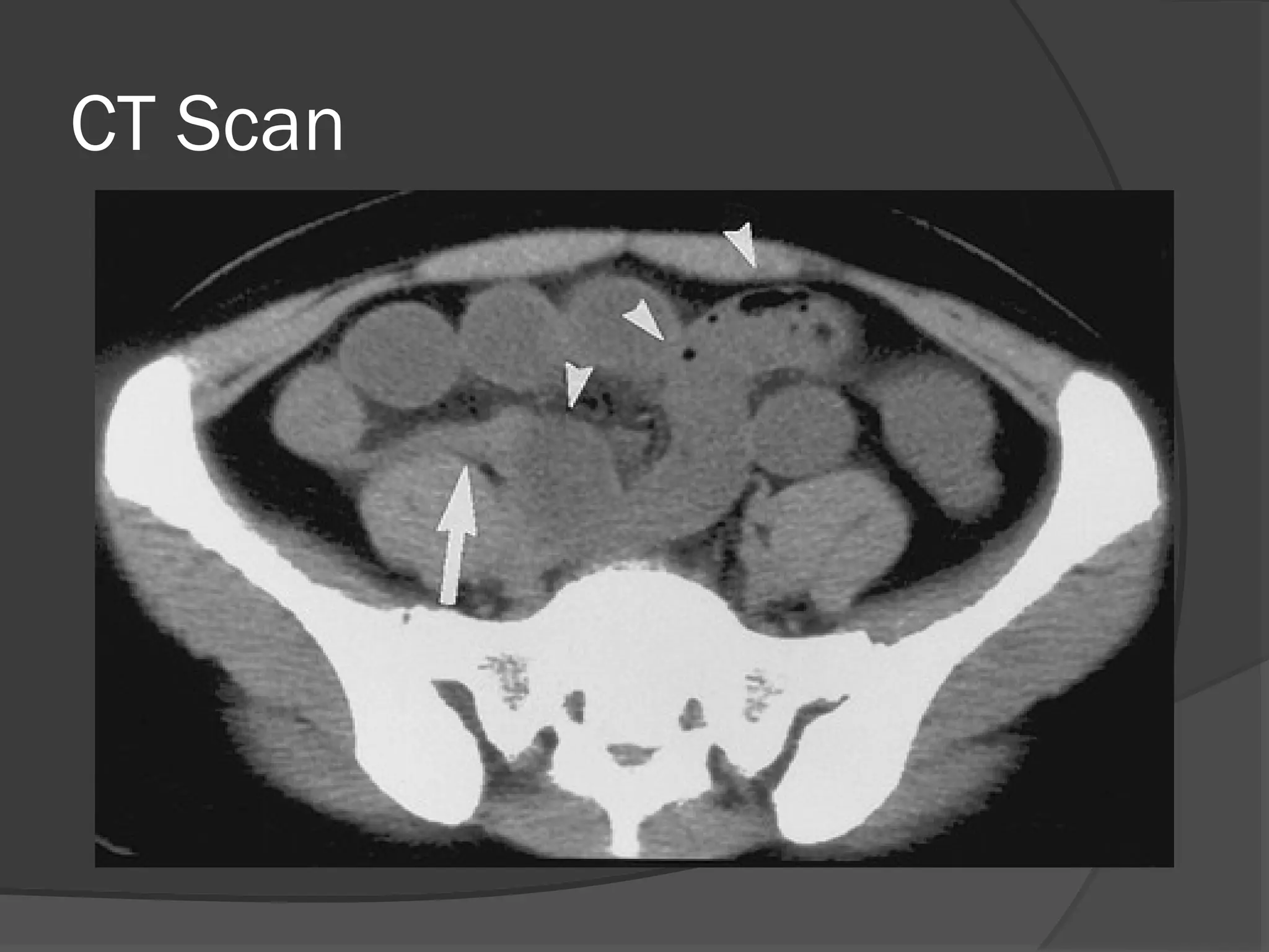 CT Scan
 