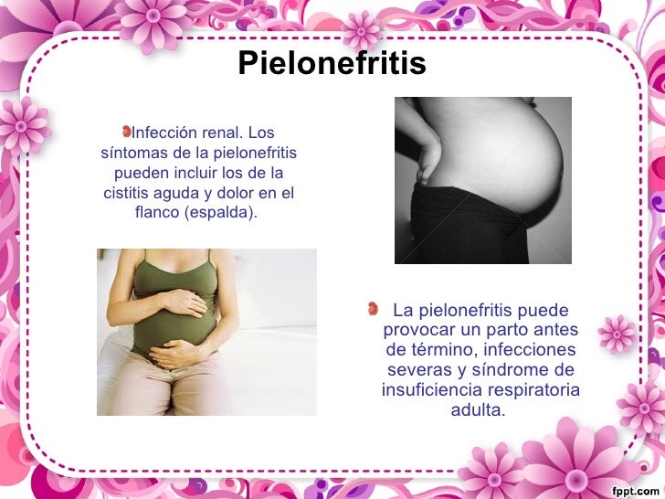 Los dolores en los riñones y en lo bajo del vientre a las mujeres el indicio del embarazo