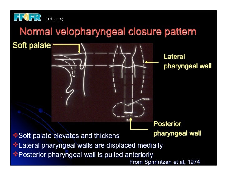 19 new speech And Velopharyngeal Function
