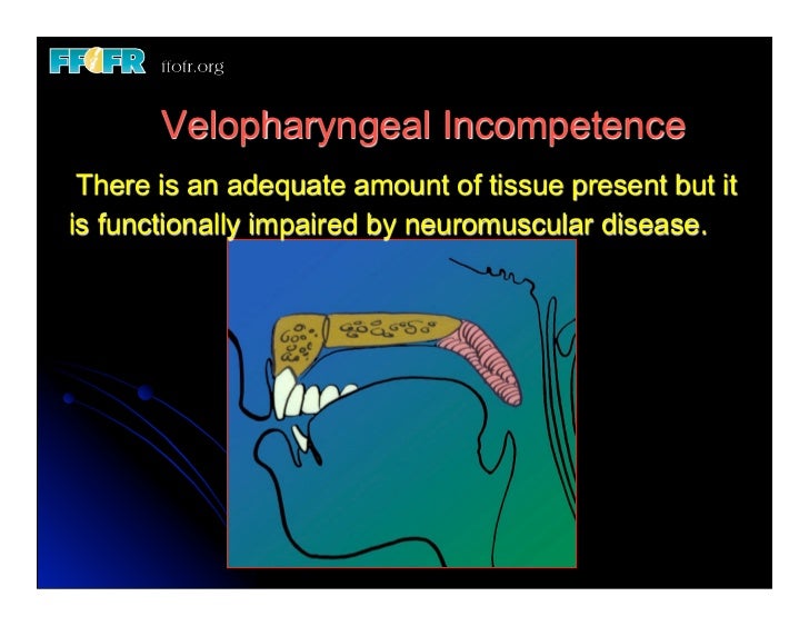 19.(new)speech and velopharyngeal function