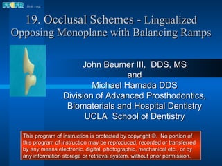 19. Occlusal Schemes -  Lingualized Opposing Monoplane with Balancing Ramps John Beumer III,  DDS, MS and Michael Hamada DDS Division of Advanced Prosthodontics, Biomaterials and Hospital Dentistry UCLA  School of Dentistry This program of instruction is protected by copyright ©.  No portion of this program of instruction may be reproduced, recorded or transferred by any means electronic, digital, photographic, mechanical etc., or by any information storage or retrieval system, without prior permission. 