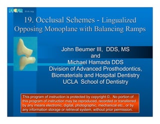 19. Occlusal Schemes - Lingualized
Opposing Monoplane with Balancing Ramps

                       John Beumer III, DDS, MS
                                   and
                          Michael Hamada DDS
                  Division of Advanced Prosthodontics,
                   Biomaterials and Hospital Dentistry
                        UCLA School of Dentistry

  This program of instruction is protected by copyright ©. No portion of
  this program of instruction may be reproduced, recorded or transferred
  by any means electronic, digital, photographic, mechanical etc., or by
  any information storage or retrieval system, without prior permission.
 