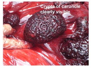 40
Crypts of caruncle
clearly visible
 