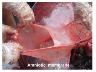 43
Amniotic membrane
 