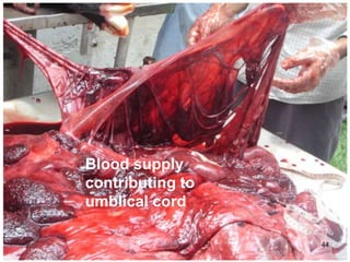 44
Blood supply
contributing to
umblical cord
 