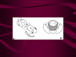 ppt on  normal labour and its management