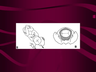 ppt on  normal labour and its management