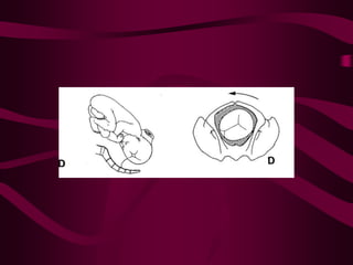 ppt on  normal labour and its management