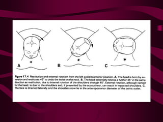 ppt on  normal labour and its management