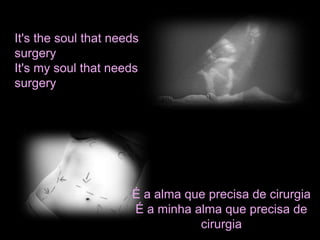 É a alma que precisa de cirurgia 
É a minha alma que precisa de 
cirurgia 
It's the soul that needs 
surgery 
It's my soul that needs 
surgery 
 