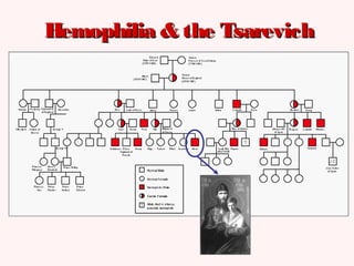 Hemophilia & the TsarevichHemophilia & the Tsarevich
 