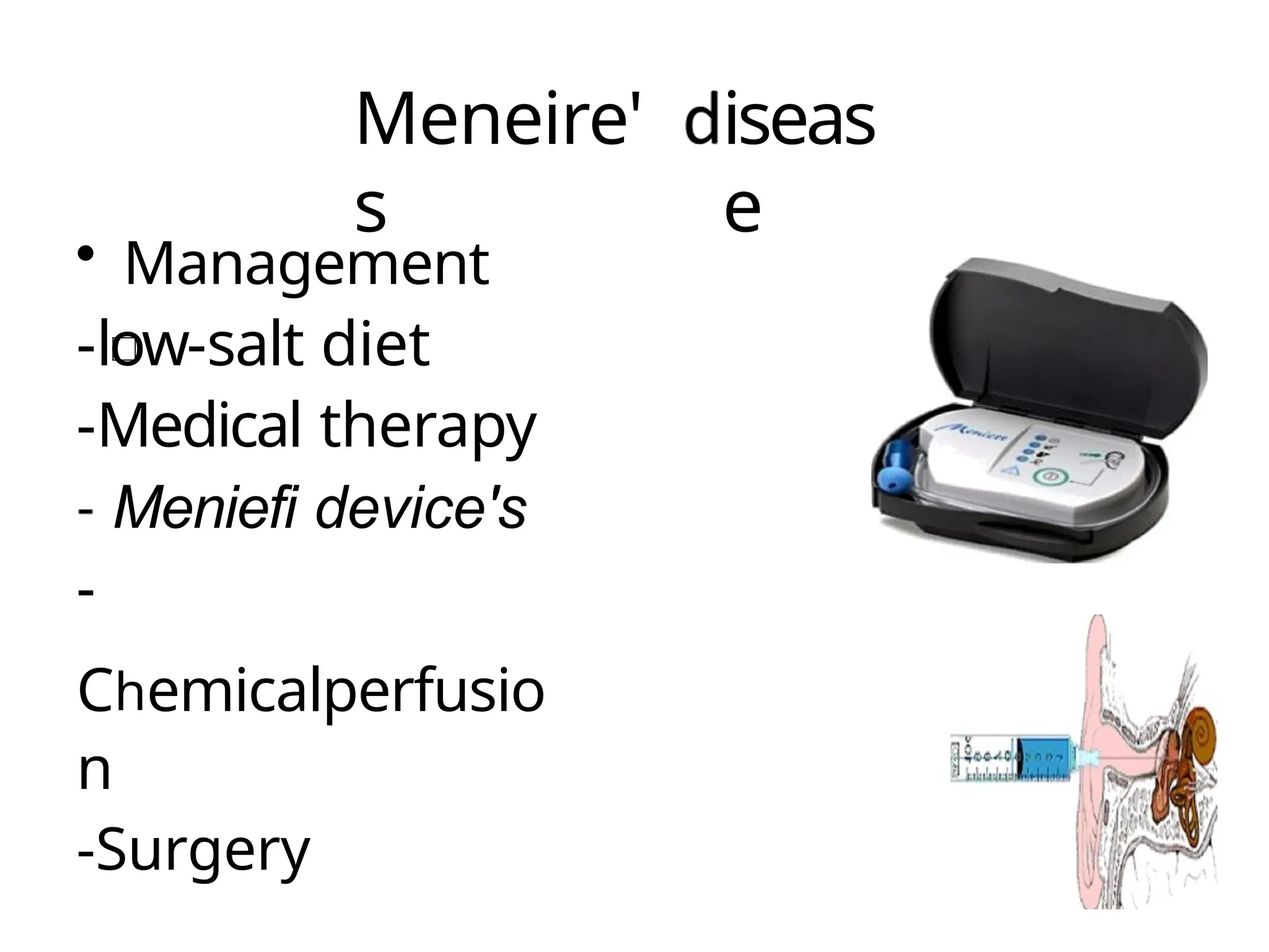Meneire'
s
iseas
e
• Management
-low-salt diet
-Medical therapy
Meniefi device's
-
Chemicalperfusio
n
-Surgery
 