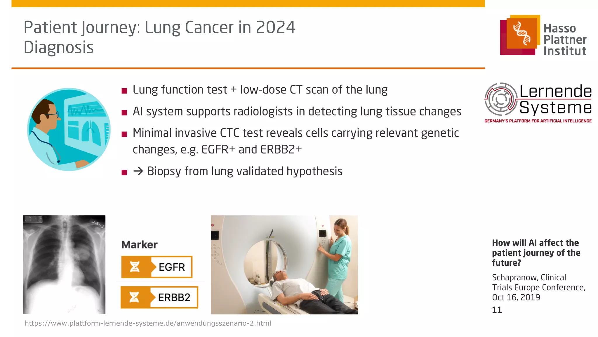 ■ Lung function test + low-dose CT scan of the lung
■ AI system supports radiologists in detecting lung tissue changes
■ Minimal invasive CTC test reveals cells carrying relevant genetic
changes, e.g. EGFR+ and ERBB2+
■ à Biopsy from lung validated hypothesis
Patient Journey: Lung Cancer in 2024
Diagnosis
Schapranow, Clinical
Trials Europe Conference,
Oct 16, 2019
How will AI affect the
patient journey of the
future?
11
https://www.plattform-lernende-systeme.de/anwendungsszenario-2.html
 