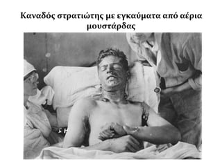 Καναδόσ ςτρατιώτησ με εγκαύματα από αϋρια
              μουςτϊρδασ
 