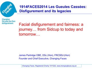 Changing Faces, Registered Charity 1011222, www.changingfaces.org.uk
1914FACES2014 Les Gueules Cassées:
Disfigurement and its legacies
Facial disfigurement and fairness: a
journey… from Sidcup to today and
tomorrow…
James Partridge OBE, DSc (Hon), FRCSEd (Hon)
Founder and Chief Executive, Changing Faces
 