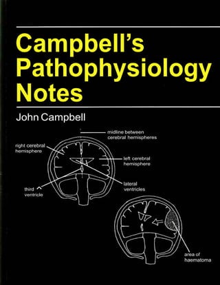 Campbells Pathophysiology Notes Campbells Notes John Campbell | PDF