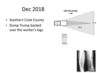 Dec 2018
• Southern Cook County
• Dump Trump backed
over the worker’s legs
 
