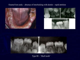 19387634-Discoloration.ppt