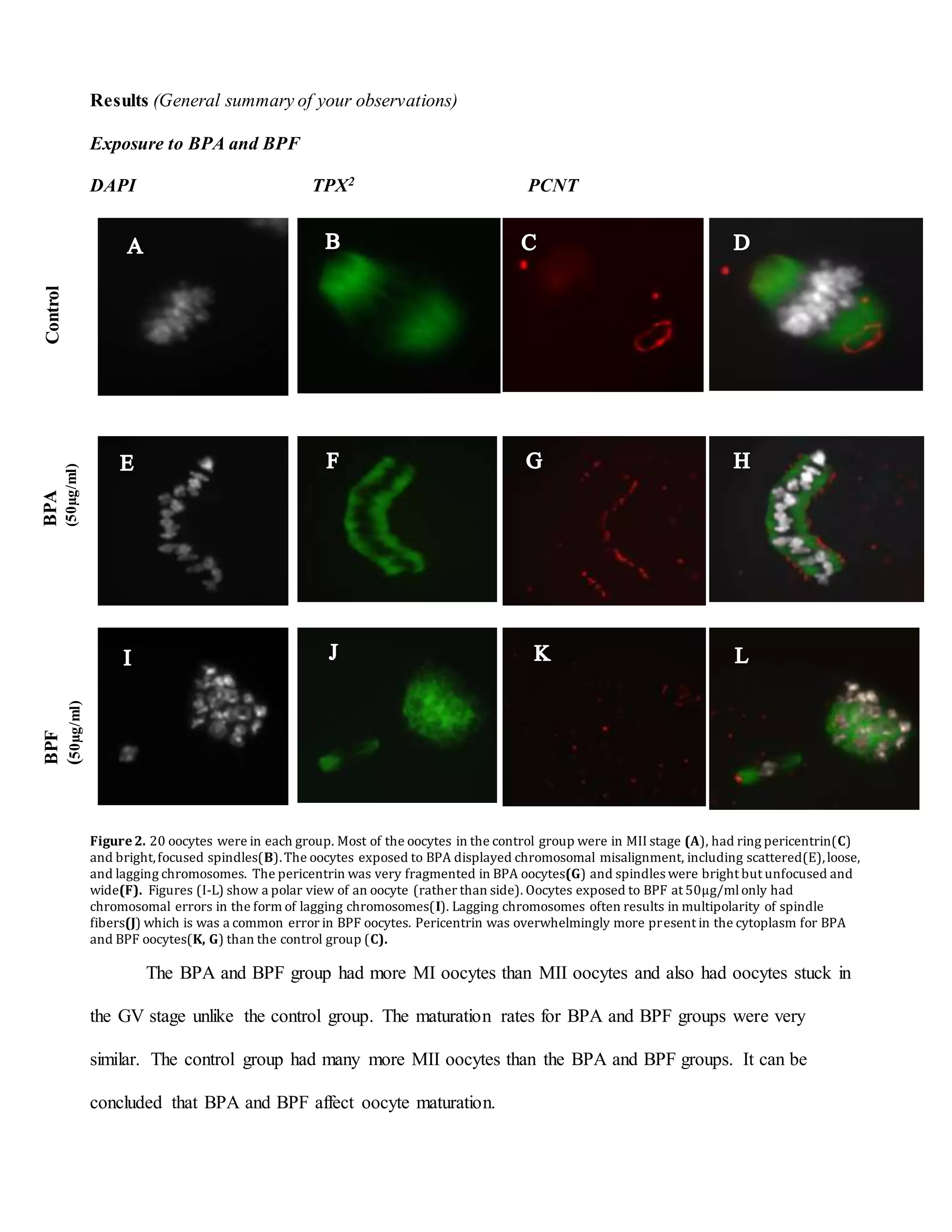Results (General summary of your observations)
Exposure to BPA and BPF
DAPI TPX2 PCNT
V
Figure2. 20 oocytes were in each group. Most of the oocytes in the control group were in MII stage (A), had ring pericentrin(C)
and bright,focused spindles(B).The oocytes exposed to BPA displayed chromosomal misalignment, including scattered(E),loose,
and lagging chromosomes. The pericentrin was very fragmented in BPA oocytes(G) and spindles were bright but unfocused and
wide(F). Figures (I-L) show a polar view of an oocyte (rather than side). Oocytes exposed to BPF at 50µg/mlonly had
chromosomal errors in the form of lagging chromosomes(I). Lagging chromosomes often results in multipolarity of spindle
fibers(J) which is was a common error in BPF oocytes. Pericentrin was overwhelmingly more present in the cytoplasm for BPA
and BPF oocytes(K, G) than the control group (C).
The BPA and BPF group had more MI oocytes than MII oocytes and also had oocytes stuck in
the GV stage unlike the control group. The maturation rates for BPA and BPF groups were very
similar. The control group had many more MII oocytes than the BPA and BPF groups. It can be
concluded that BPA and BPF affect oocyte maturation.
ControlBPA
(50µg/ml)
BPF
(50µg/ml)
 