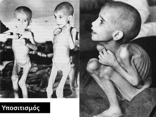 Υποσιτισμός
 