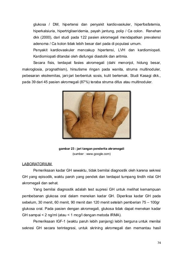 194598945 makalah-kelainan-hipotalamus-case-1-ems-1 194598945 makalah-kelainan-hipotalamus-case-1-ems-1