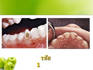 รหัส  1  