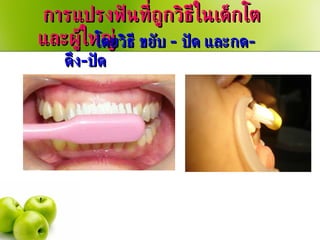 การแปรงฟันที่ถูกวิธีในเด็กโต และผู้ใหญ่ โดยวิธี ขยับ  -  ปัด และกด - ดึง - ปัด 