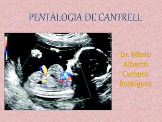 PENTALOGIA DE CANTRELL
Dr. Mario
Alberto
Campos
Rodríguez
 