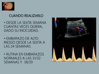 CUANDO REALIZARLO
• DESDE LA SEXTA SEMANA
CUANTAS VECES QUIERA,
DADO SU INOCUIDAD.
• EMBARAZO DE ALTO
RIESGO DESDE LA SEXTA A
LAS 24 SEMANAS
• RUTINA EN EMBARAZOS
NORMALES A LAS 31/32
SEMANAS Y 38/39
 