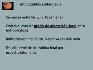 Amniocentesis intermedia
Se realiza entre las 20 y 35 semanas
Objetivo: evaluar grado de afectación fetal en la
eritroblastosis
Indicaciones: madre Rh. Negativa sensibilizada
Estudia: nivel de bilirrubina fetal por
espectrofotometría
 