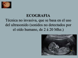ECOGRAFIA
Técnica no invasiva, que se basa en el uso
del ultrasonido (sonidos no detectados por
el oído humano, de 2 á 20 Mhz.)
 