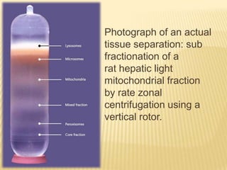 Photograph of an actual
tissue separation: sub
fractionation of a
rat hepatic light
mitochondrial fraction
by rate zonal
centrifugation using a
vertical rotor.

 